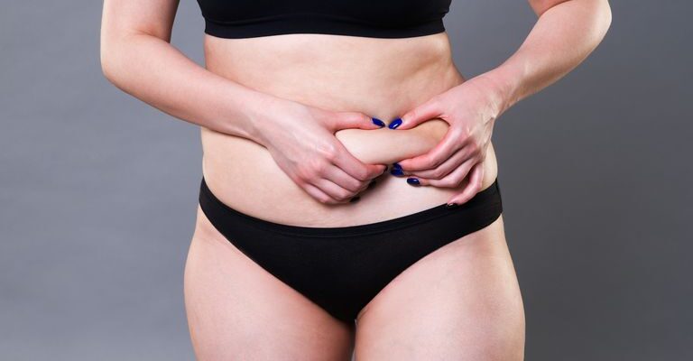 Fat-ReductionLiposuction-Abdominoplasty